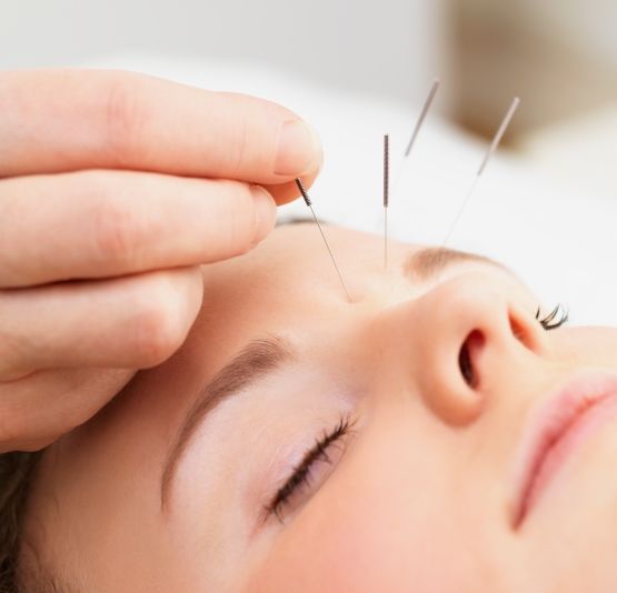 acupuncture-redondo-beach